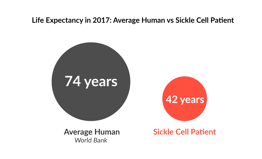 sickle cell anemia life expectancy        
        <figure class=